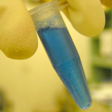 Brilliant Blue / Coomassie Blue staining protein; white flecks are DNA