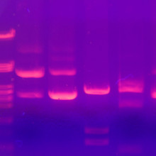 DNA electrophoresis