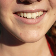 Smile Smile