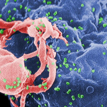 HIV viruses in green budding from a lymphocyte