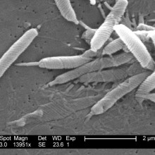 Scanning electron micrograph of Helicobacter bacteria