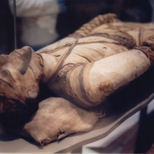 Tubercular decay of Egyptian Mummy