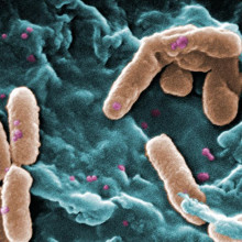 Pseudomonas bacteria