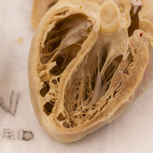 Human Heart Plastinate