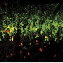 The region of the brain that links stress and depression has been identified.