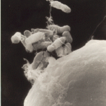 Agrobacterium tumefaciens, as they begin to infect a carrot cell. In the process, the bacterial genetic material will enter the plant cell, altering growth.