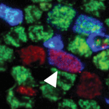 Human airway cells labelled