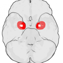  The figure shows the underside (ventral view) of a semi-transparent human brain, with the front of the brain at the top. The red blobs show the approximate location of the en:amygdala in the en:temporal lobes of the human brain. Note: the amygdala is...