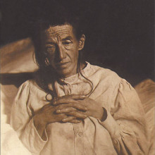 Alois Alzheimer's patient Auguste Deter in 1902. Hers was the first described case of what became known as Alzheimer's disease.