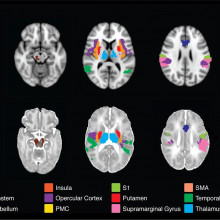 Comparison between infant and adult pain reactions by Rebeccah Slater, Oxford University.