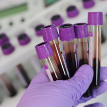 Tubes of blood for a blood test