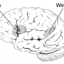 Approximate location of Broca's and Wernicke's areas highlighted in gray