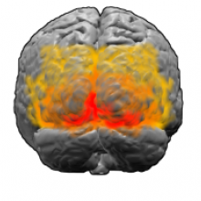  Brodmann areas 17, 18 and 19. BA 17 is shown in red. BA 18 is orange. BA 19 is yellow. This is a rear view of the brain. Much of BA 17 is hidden from view on the medial surface (between the hemispheres), on the ventral bank of the calcarine sulcus...