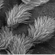 Scanning electron microscope image of lung trachea epithelium. There are both ciliated and on-ciliated cells in this epithelium. Note the difference in size between the cilia and the microvilli(on non-ciliated cell surface)