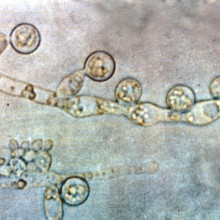 Candida albicans