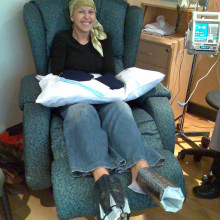 This woman is being treated with docetaxel for breast cancer. This woman is being treated with docetaxel for breast cancer. Cooling mits and wine coolers are placed on her hands and feet to prevent deleterious effects on the nails. Similar strategies can be used to prevent hair loss.