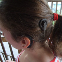 A cochlear implant as worn by the user