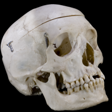 A human skull