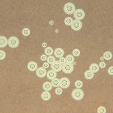 Crytococcus neoformans, a radiotrophic fungus