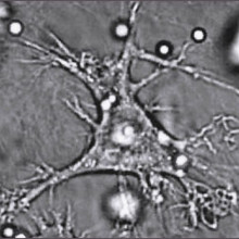 A Dendritic Cell