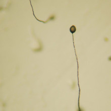 Dictyostelium Fruiting Body