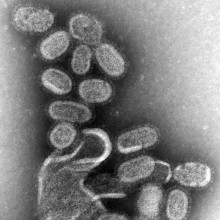 Influenza virus as seen under EM. This orthomyxovirus has pleomorphic (variable) shaped particles surrounded by a lipid envelope studded with viral proteins.