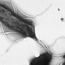 Electron micrograph of H. pylori possessing multiple flagella (negative staining)