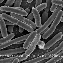 Escherichia coli: Scanning electron micrograph of Escherichia coli, grown in culture and adhered to a cover slip.