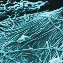 The ebola filovirus, which causes ebola haemorrhagic fever, a frequently fatal infection carried by fruit bats.