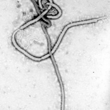 Ebola virus, as seen under an electron microscope. Ebola is a member of the filovirus family. The tubular \shepherd's crook\-shaped particles are generally 80nm in diameter and up to 1000nm long.