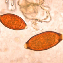 Eggs of Trichuris trichiura and Trichuris vulpis. The T. vulpis egg is the larger of the two. Parasite.