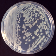 Colonies of Enterobacter cloacae bacteria on Tryptic Soy Broth agar plate. Obtained from the CDC Public Health Image Library; image credit: CDC(PHIL #6552), 1983.