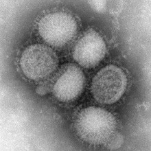 Electron micrograph showing several particles of the H1N1 influenza virus. Each particle measures about 100nm in diameter.