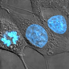 HeLa cells stained with Hoechst 33258 stain.