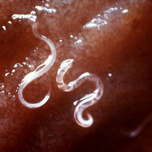 ''Ancylostoma caninum'', a type of hookworm, attached to the intestinal mucosa. Hookworms are blood-sucking nematodes that feed on blood. Heavy infections can cause anaemia due to loss of blood.