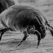 Dermatophagoides pteronyssinus - North American House Dust Mite, a major creator of allergens