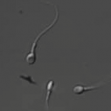 Human Sperm Human sperm