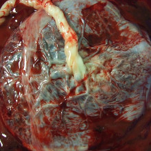 Human placenta