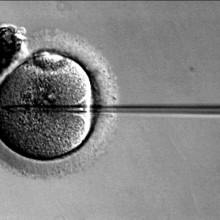 IVF technology