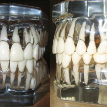 Models of human teeth as they exist within the alveolar bone.