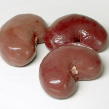 Kidneys - these are actually Lamb kidneys, not human ones, but these will do for illustration purposes...