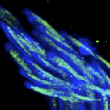 HP1E expression (green) during sperm development disappears in mature sperm.