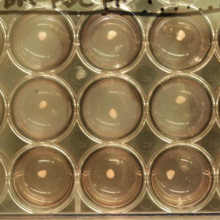Human iPSC-derived liver bud. Human iPSC-derived liver bud.