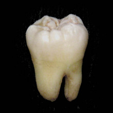 Human tooth