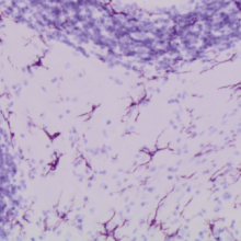 Brain from risperidone-treated mice with MS-like disease Risperidone treatment significantly reduces microglial activation in the CNS of mice with an MS-like disease. Image: Anne la Flamme, PLoS One, 2014.