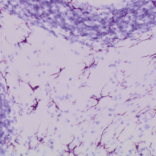 Risperidone treatment significantly reduces microglial activation in the CNS of mice with an MS-like disease. Image: Anne la Flamme, PLoS One, 2014.