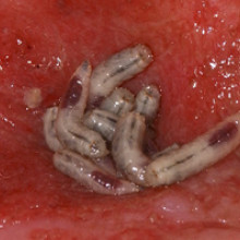 Maggots in a wound