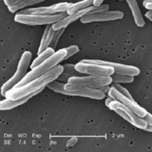 Mycobacterium tuberculosis (TB) bacteria seen under scanning electron microscope (x15000)