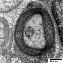 Transmission electron micrograph of a myelinated axon. Generated and deposited into the public domain by the Electron Microscopy Facility at Trinity College.