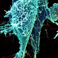 String-like Ebola virus particles are shedding from an infected cell in this electron micrograph